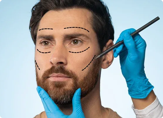 Cosmeticoplasty